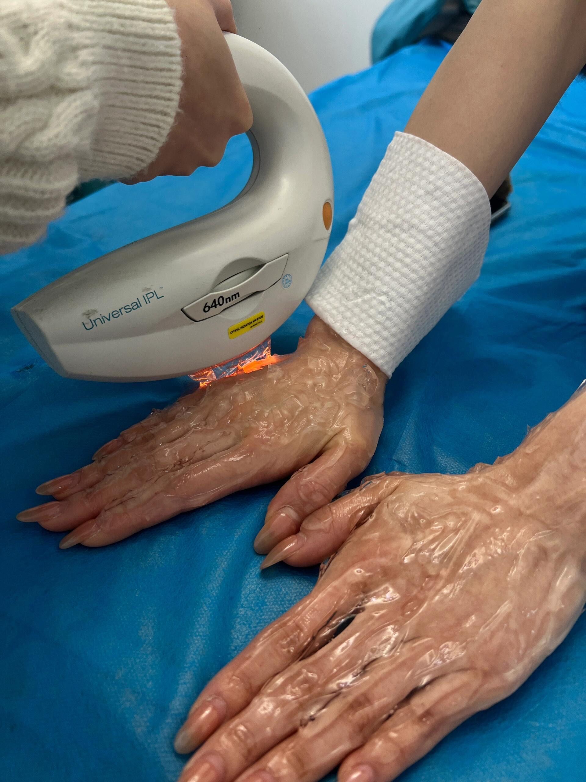 为什么不建议光子嫩肤 为什么不建议光子嫩肤