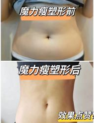 -Lily纤美·科技减脂中心
