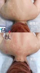 -升艾堂亚健康调理中心