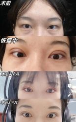 -素美医疗美容·西南眼鼻整形·修复基地