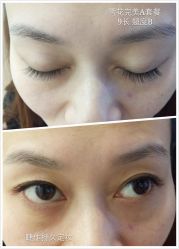 睫毛嫁接-光SPA科技美肤