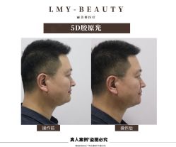 -丽美妍医疗美容·皮秒·立体分层抗衰