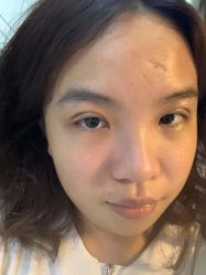 -素美医疗美容·西南眼鼻整形·修复基地