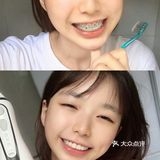 炸了！暑期矫牙好时节？   我是一位22岁的宝宝