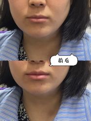 -Yestar重庆艺星医疗美容医院