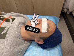 体验前-针美汇欧邦医疗美容