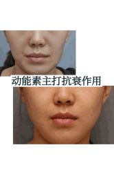-八大处整形