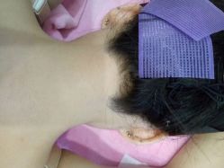 -咪咪专业脱毛连锁机构