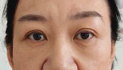 -天津健丽·去眼袋医疗美容机构