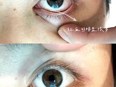 -艾通康缘艾灸.疼痛.睡眠养生馆(凤凰城店)