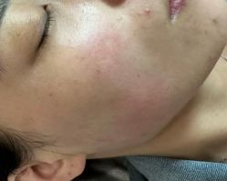 -杭州米兰柏羽医疗美容医院