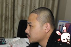 -大麦微针植发丨全国连锁