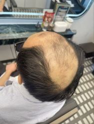 -唐风采假发补发定制