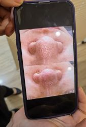 -skin79皮肤管理中心