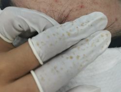 -蕾特恩专业祛痘·皮肤管理
