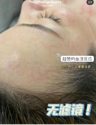 -MLP美丽派·问题肌疗愈中心