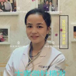 点击看大图 -大麦微针植发丨全国连锁