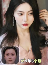 -北京米扬丽格医疗美容·联合丽格鼻整形中心