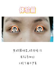 体验前-维秘形体医美 M·VVON医生集团