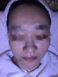 -皇族养心堂·净痘·修敏·御颜