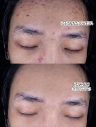 -Yestar重庆艺星医疗美容医院