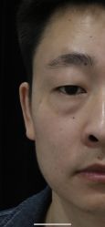 -Yestar宁波艺星整形医院
