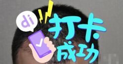 -大麦微针植发全国连锁