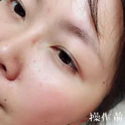 -西施无菌半永久纹绣眉眼影唇轻增发纹发际线