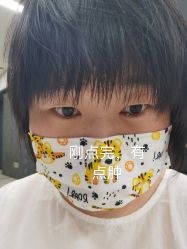体验后-北京美痣堂古方祛痣斑疣瘊