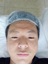 -悟空祛痘·诺奖技术专业店