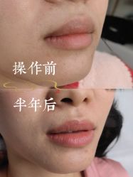 -西施无菌半永久纹绣眉眼影唇轻增发纹发际线