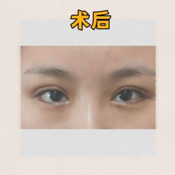 -素美医疗美容·西南眼鼻整形·修复基地