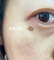 -小忠丽格医美