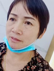 -莲姿娜半永久纹眉皮肤管理