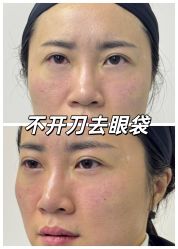 -广州健丽·去眼袋医疗美容机构
