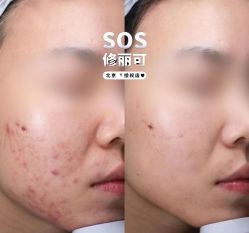 -SOS修丽可.痘肌修复中心
