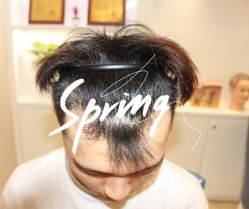 -大麦微针植发全国连锁