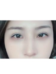 -天津健丽·去眼袋医疗美容机构
