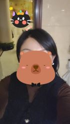 -碧莲盛·不剃发植发