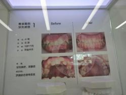 -青苗儿童口腔(长楹天街购物中心)