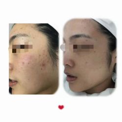 -康美贞·痘肌养护管理中心