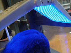 -碧莲盛·不剃发植发