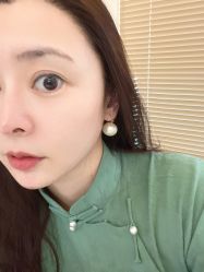 体验后-skin79皮肤管理中心