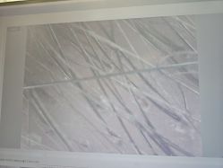 -碧莲盛·不剃发植发