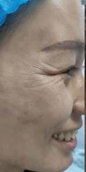 -郡艺医疗美容·微整·眼鼻吸脂