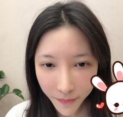 点击看大图 -大麦微针植发丨全国连锁