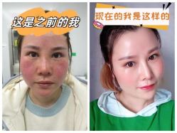 -素美医疗美容·西南眼鼻整形·修复基地