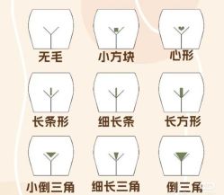 -薇兰专业脱毛连锁机构