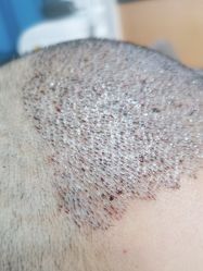 -雍禾植发全国连锁