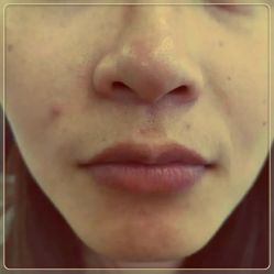 -SKINIST丽铂医疗美容
